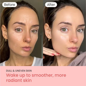 QUIA peeling off mask in morning to reveal smoother, rested skin