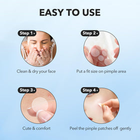 QUSTERE patches in a travel bag ready for on-the-go blemish protection