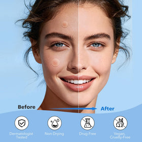 QUSTERE texture view under light highlighting hydrocolloid clarity and absorption