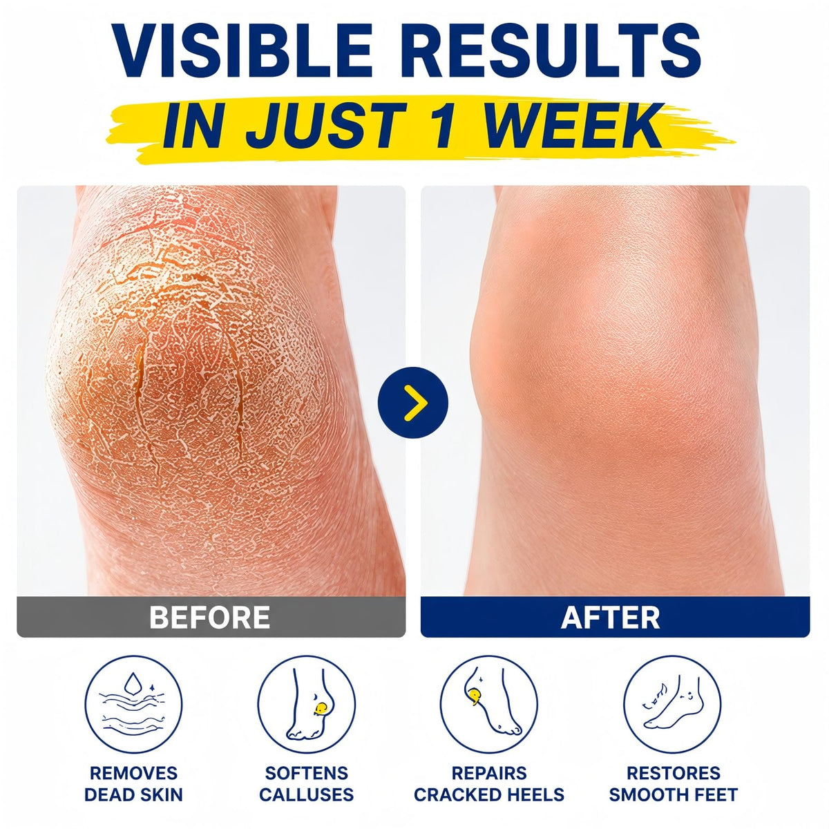 QVCQ applying stick to heel demonstrating targeted softening