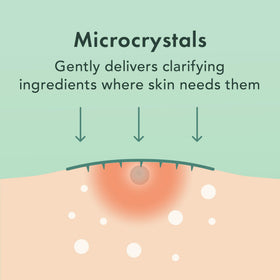 Rael hydrocolloid texture detail illustrating breathable barrier and skin protection