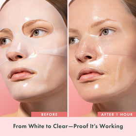 Rael mask fitting side profile, demonstrating secure no-slip adhesion