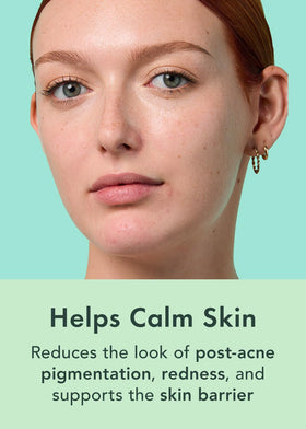 Rael serum drops on hand showing product amount and controlled application
