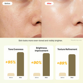 RAUME close-up dropper dispensing serum highlighting precise application and control