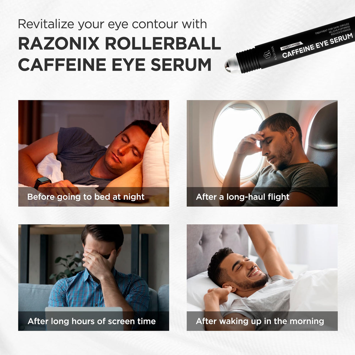 RAZONIX side-by-side before and after under-eye example showing reduced puffiness appearance