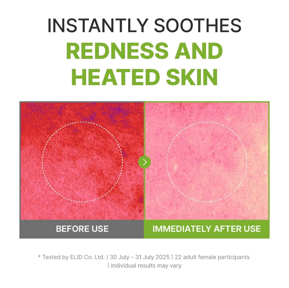 Centella leaves beside Rbfy product highlighting soothing plant benefit