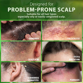 Recuren Plus ingredients label showing piroctone olamine and botanical actives for reassurance