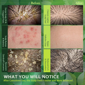 Recuren Plus being massaged into the scalp to show proper application and soothing action