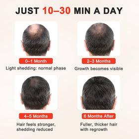 Red Light Hair Growth Cap worn while reading showing hands-free convenience benefit