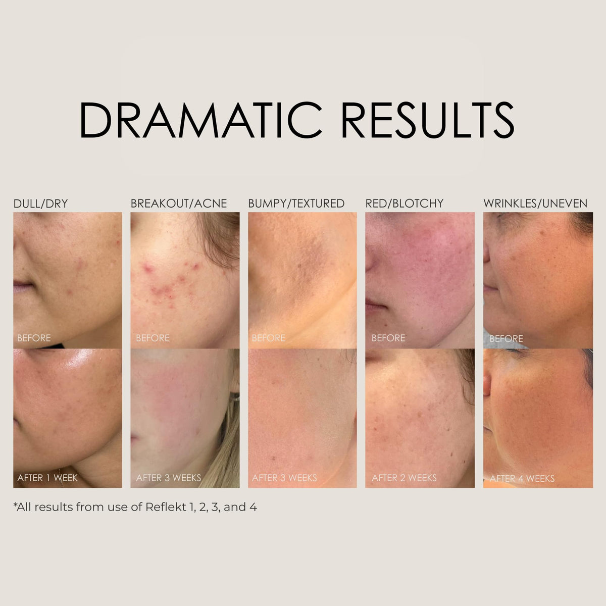 REFLEKT product in hand applying gel for gentle exfoliation and hydration benefit