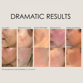 REFLEKT product in hand applying gel for gentle exfoliation and hydration benefit