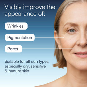 REGELICA illustrative before and after showing improved texture and reduced spots