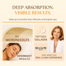 ReGlow before-and-after simulation showing smoother under-eye appearance