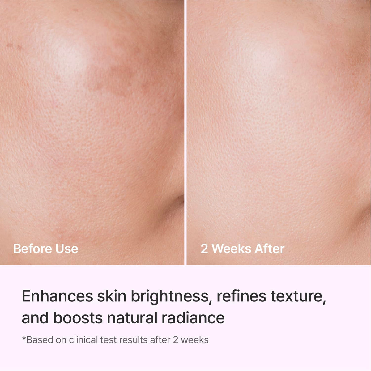 REJURAN serum on hand demonstrating smooth application and quick absorption benefit