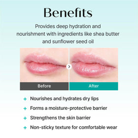 REJURAN balm applied on lips demonstrating soothing hydration