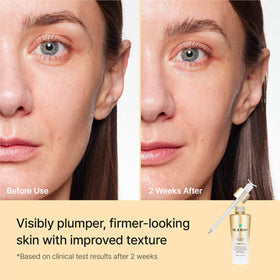 REJURAN close-up ampoule droplet showing lightweight hydration benefit
