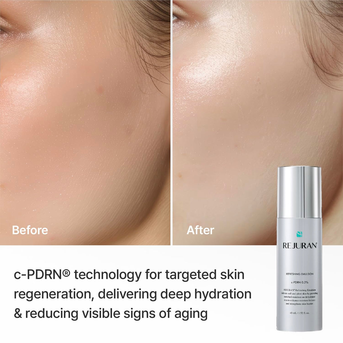 REJURAN emulsion being dispensed on hand to show lightweight application benefit