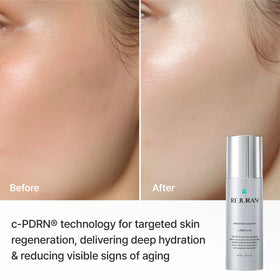 REJURAN emulsion being dispensed on hand to show lightweight application benefit