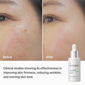 REJURAN ingredients label focused on c-PDRN 0.5% and retinol transparency benefit