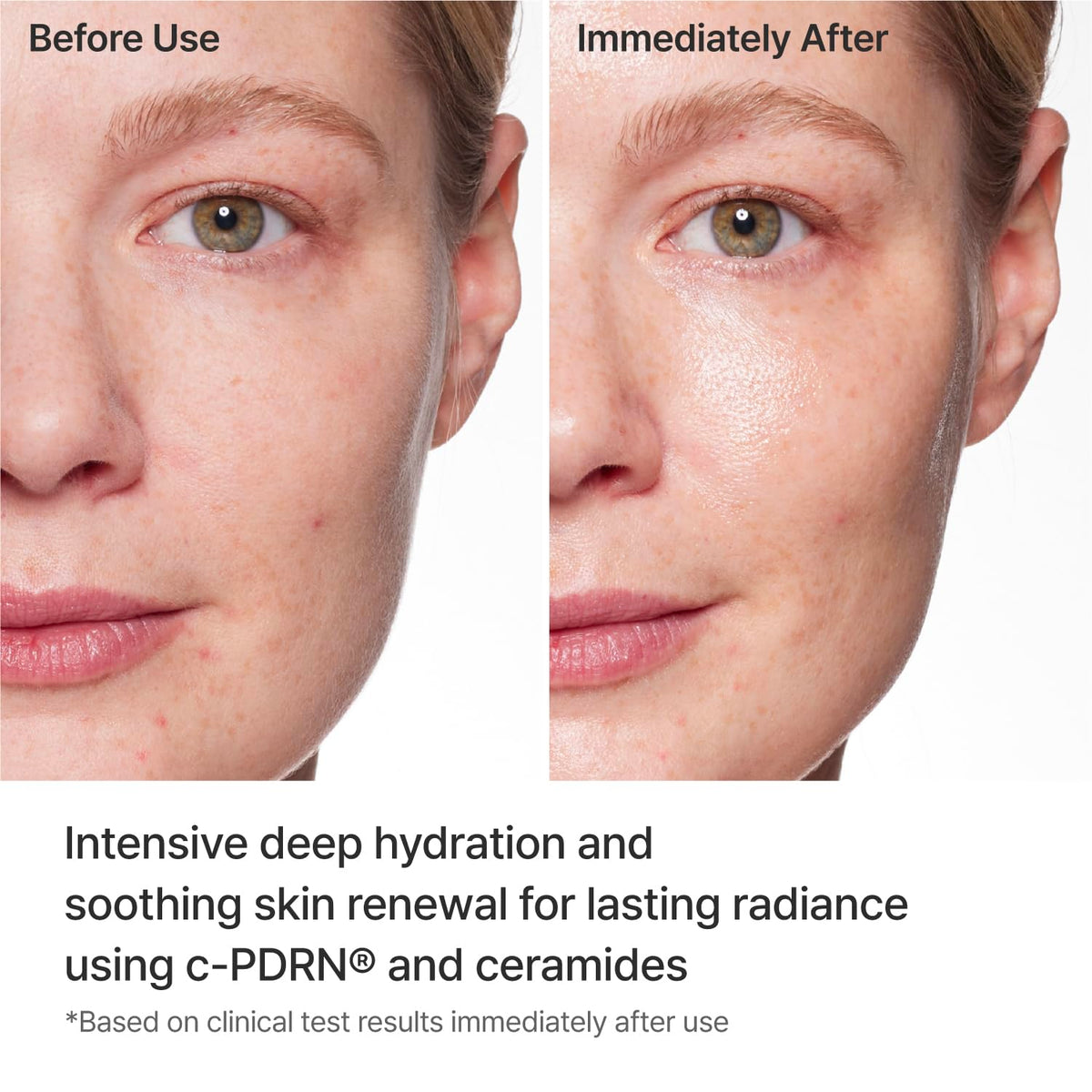 REJURAN mask texture with serum drip demonstrating rich hydration delivery