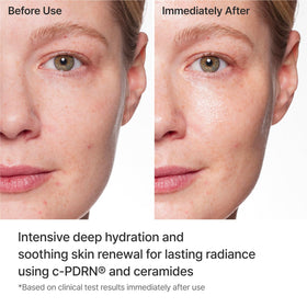 REJURAN mask texture with serum drip demonstrating rich hydration delivery