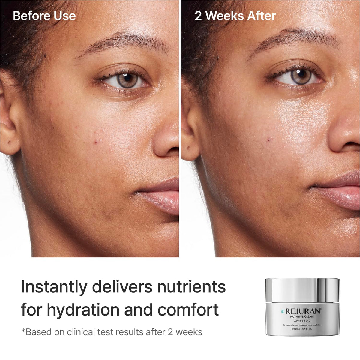 REJURAN salmon serum ingredient close-up highlighting nutrient-rich formulation