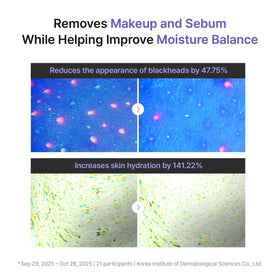 REJURAN balm being applied in hand illustrating smooth texture and easy spread