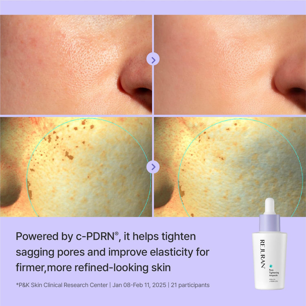 REJURAN serum on hand to demonstrate dropper amount and scale