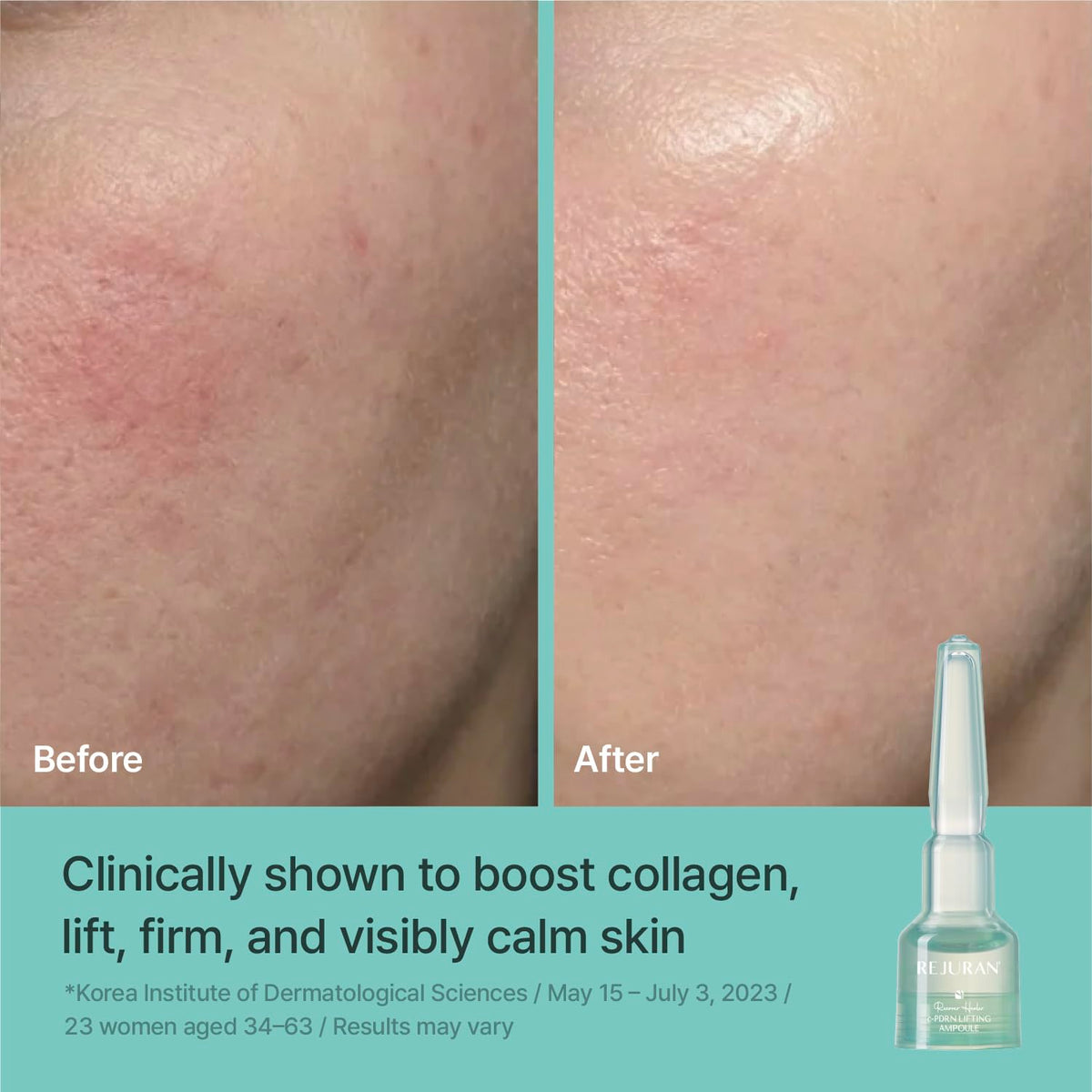 REJURAN ampoule being applied to skin from hand, demonstrates easy tap-and-apply use