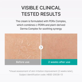 REJURAN ingredient label highlighting c-PDRN and PDRx Complex benefits