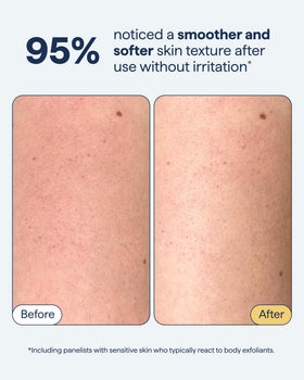 Remedy Science close-up of fine sugar granules gentle exfoliation