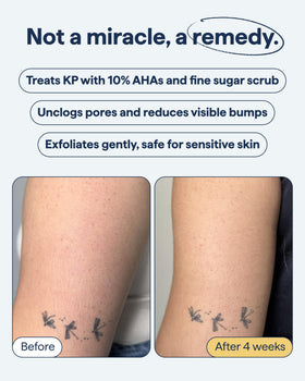 Remedy Science rinse clean under water leaving skin soft