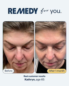 Remedy Science gel-lotion texture on fingertip showing lightweight absorbent finish