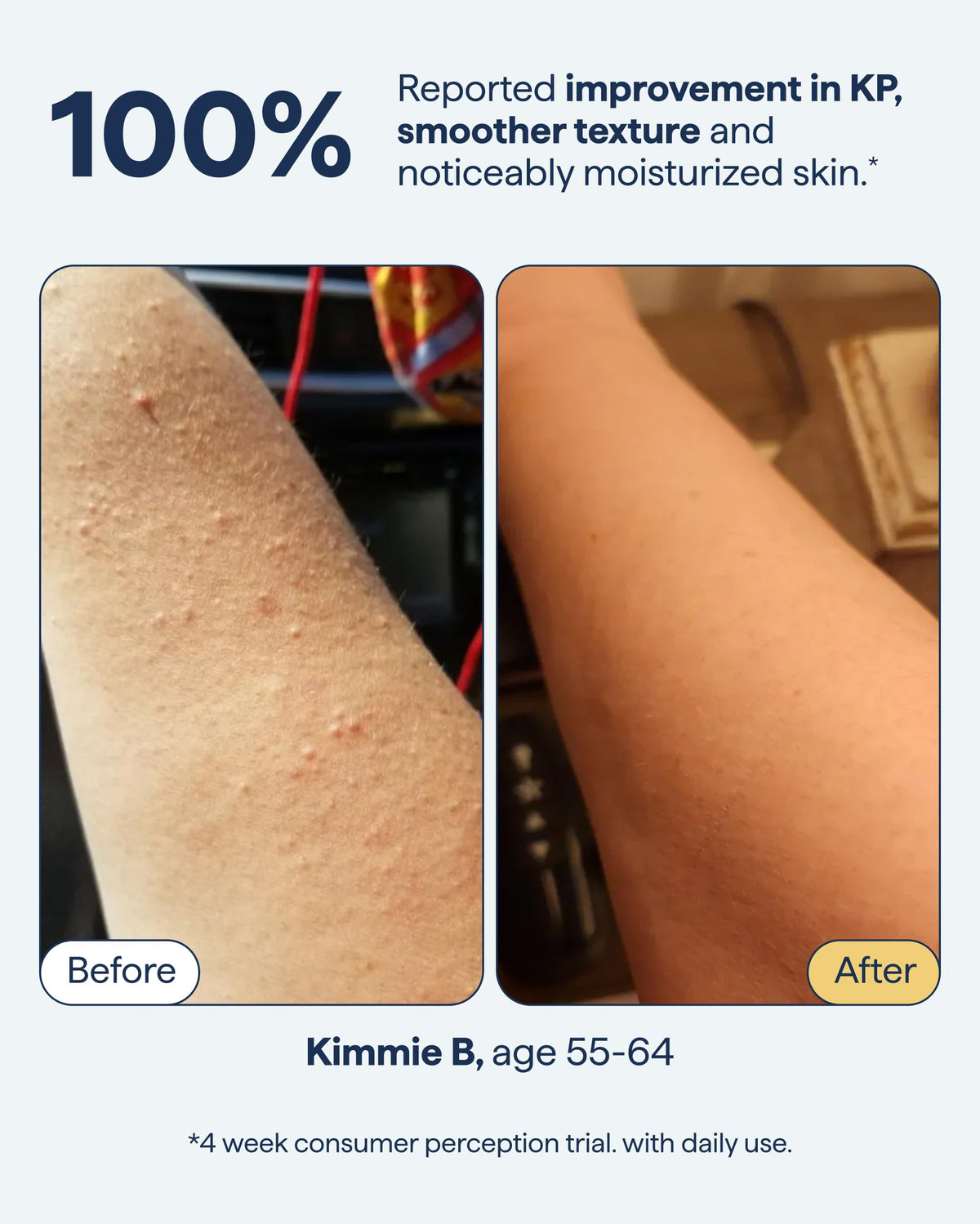 Remedy Science key actives visual showing retinol urea lactic acid ceramides
