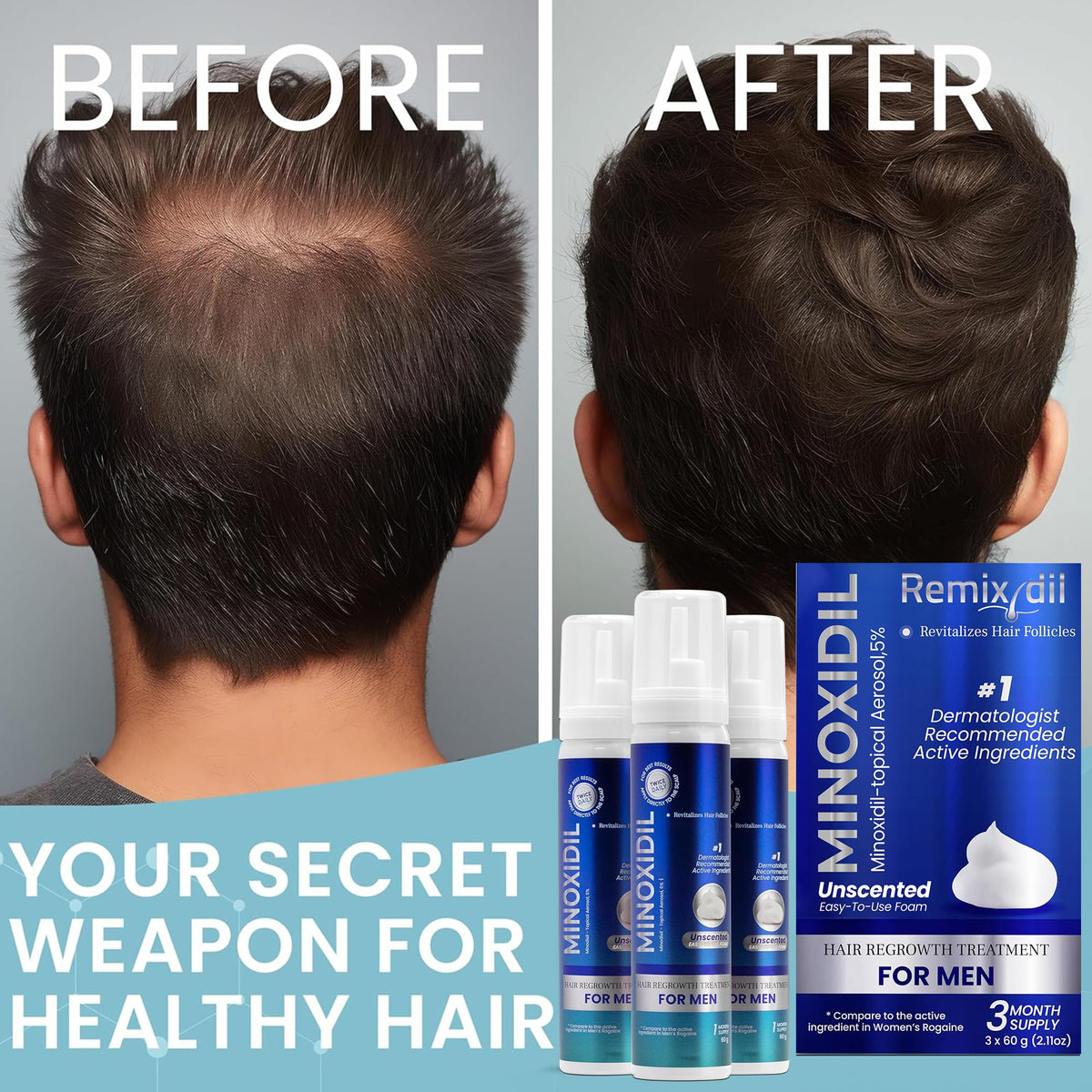 Rida Hair Research Institute Remixidil on bathroom counter in morning routine supporting consistent use