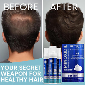 Rida Hair Research Institute Remixidil on bathroom counter in morning routine supporting consistent use