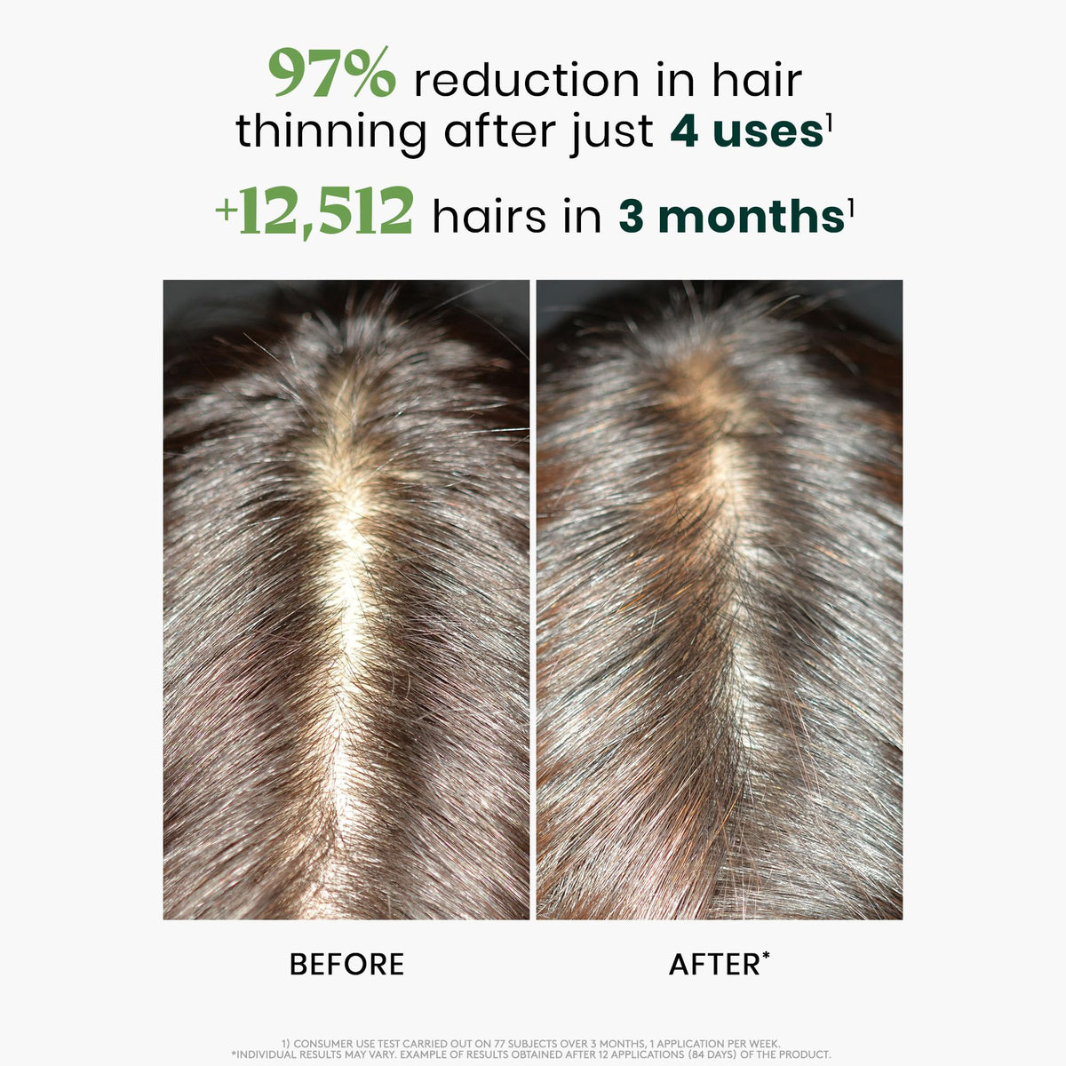 René Furterer applicator attached to an ampoule for precise scalp delivery