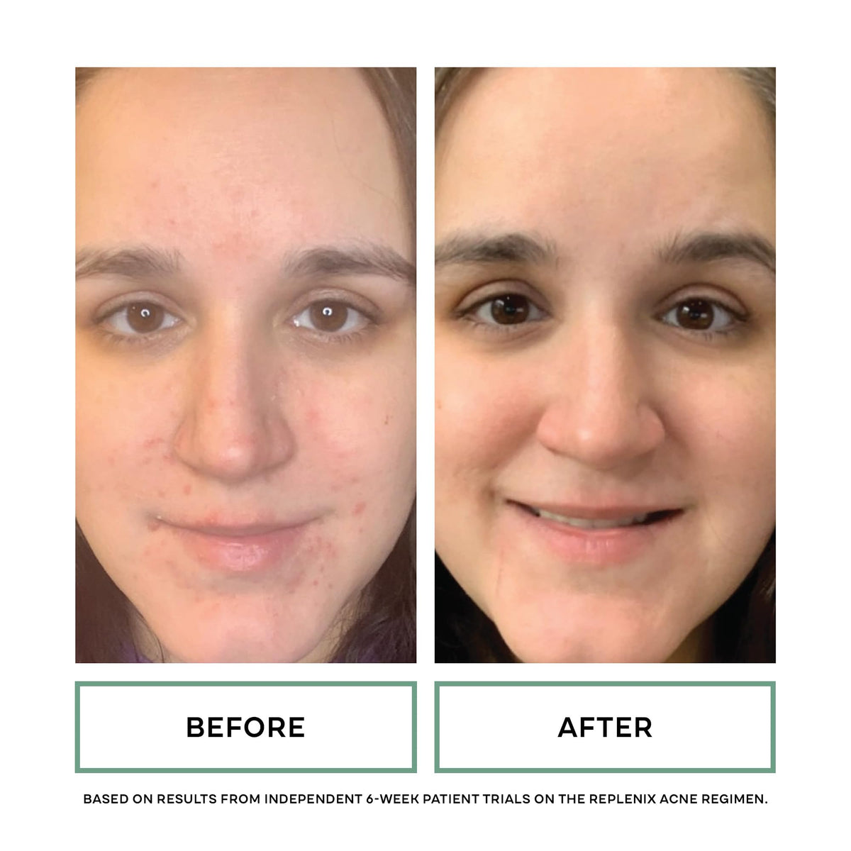 Replenix ingredients label highlighting glycolic and salicylic acids