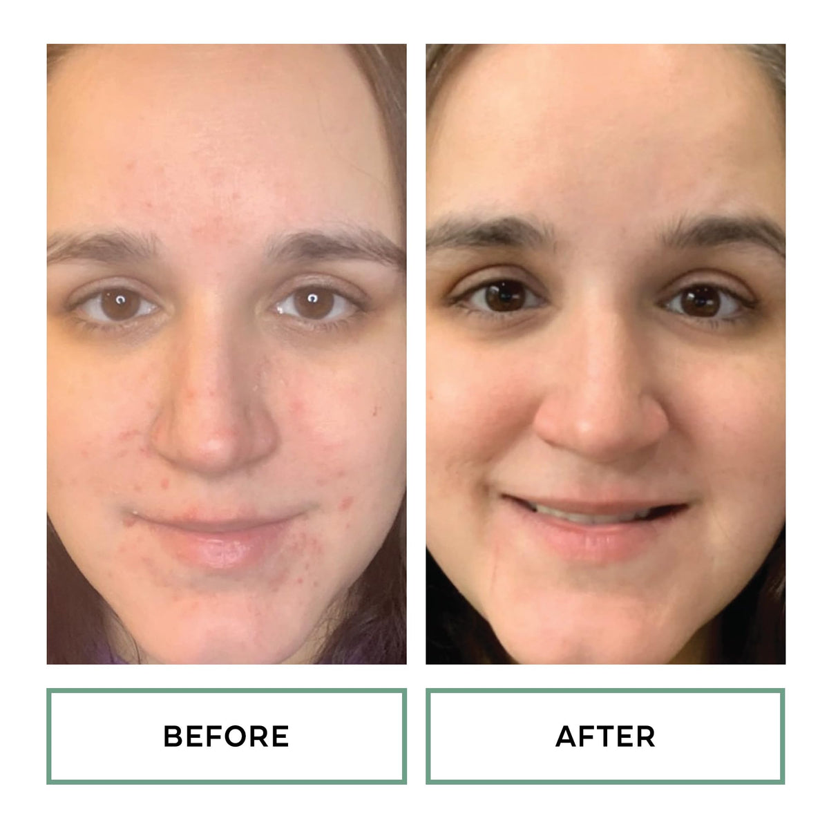 replenix label close-up highlighting 10% glycolic and 2% salicylic