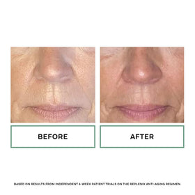 Replenix ingredients label close-up highlighting antioxidant components benefit