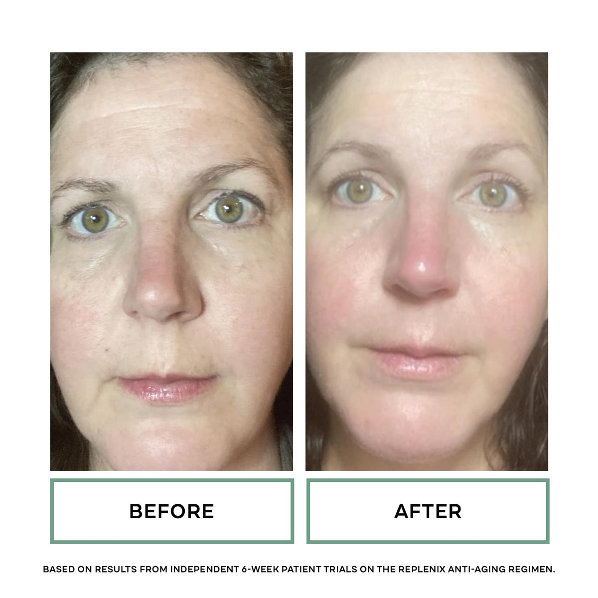 Replenix serum used in a morning routine beside moisturizer and sunscreen for layered benefits
