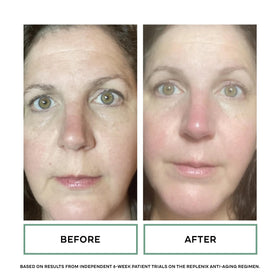 Replenix serum used in a morning routine beside moisturizer and sunscreen for layered benefits