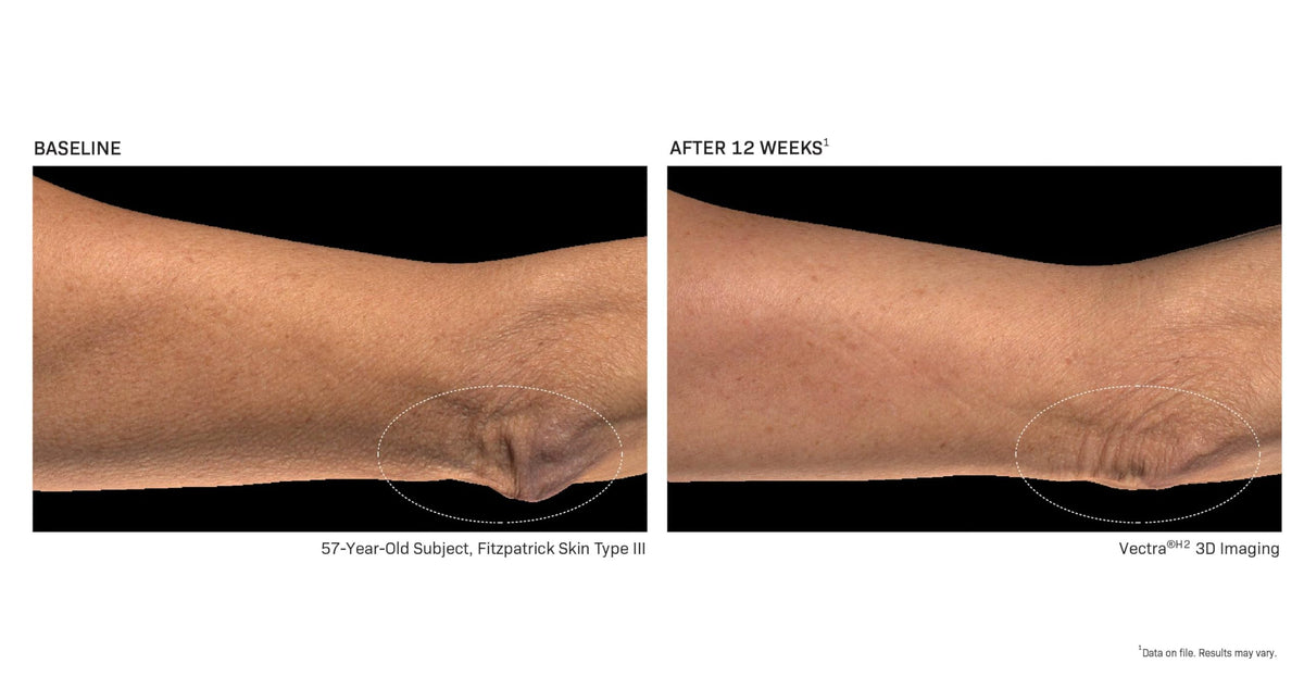 Revision Skincare BodiContour™ next to hand showing 3.8 oz size and travel benefit
