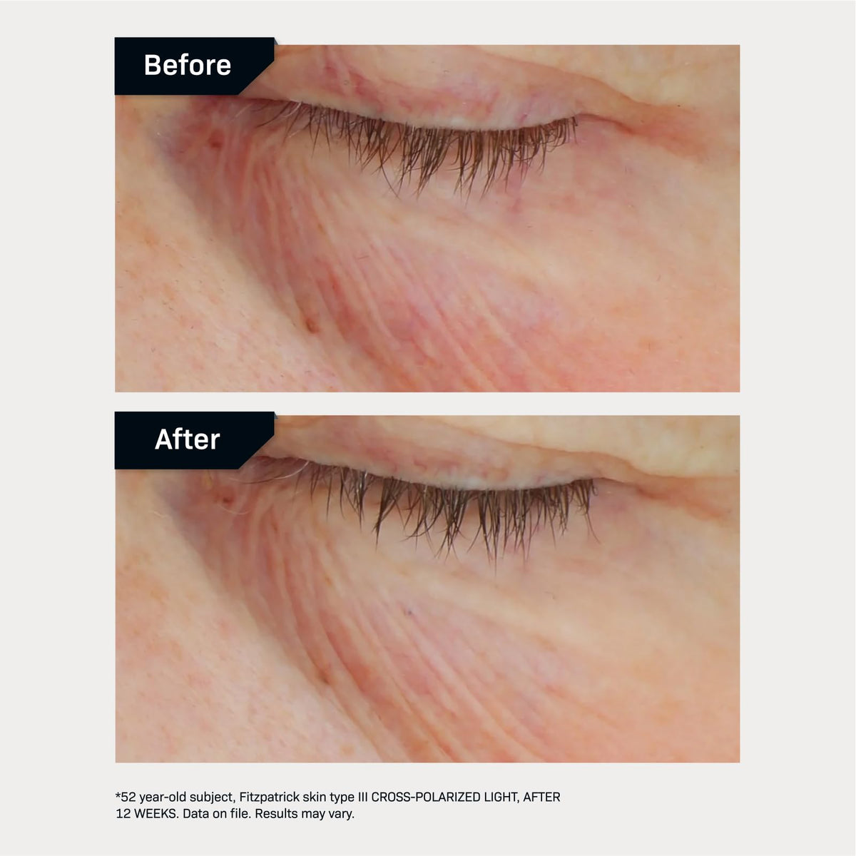 Revision Skincare applied on hand to demonstrate texture and quick absorption