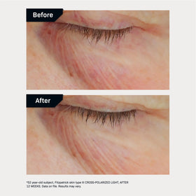 Revision Skincare applied on hand to demonstrate texture and quick absorption