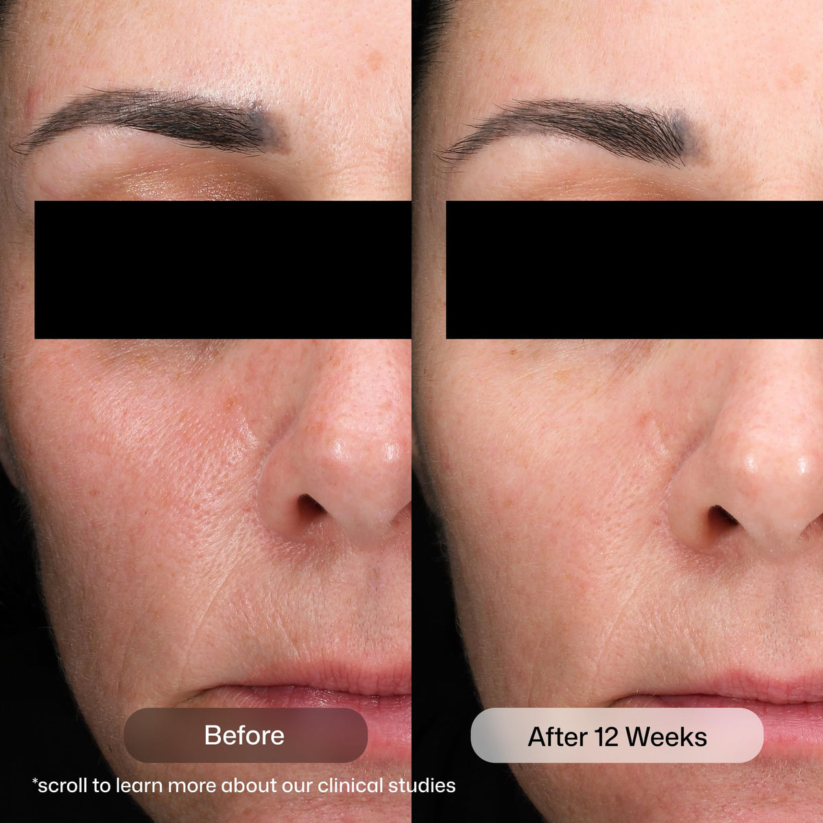 Revision Skincare close-up of serum texture demonstrating lightweight absorbency and smooth finish
