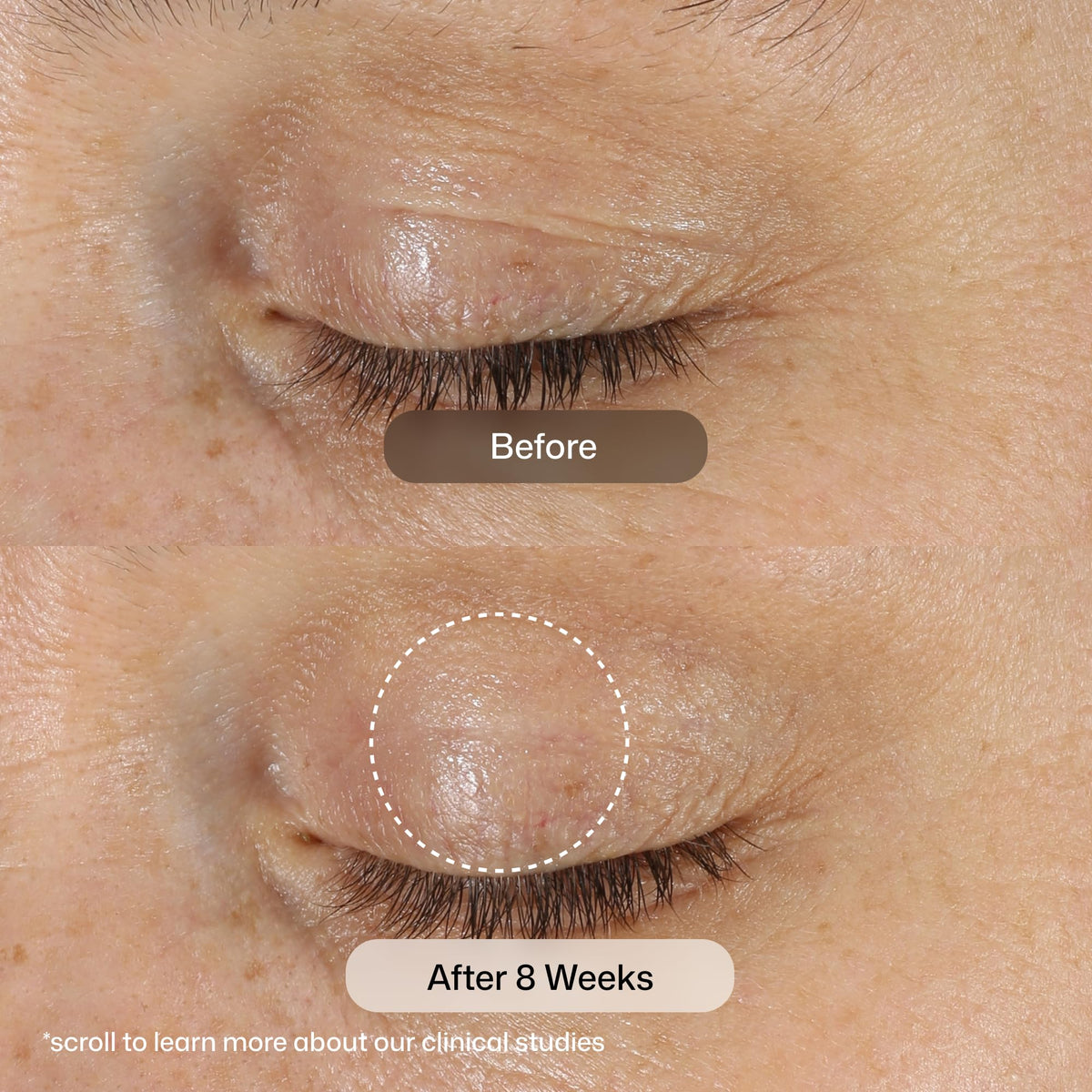 Revision Skincare D·E·J Eye Cream dispenser detail for measured application