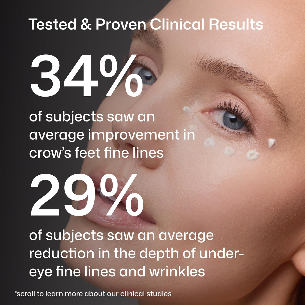 Revision Skincare D·E·J Eye Cream before-after under-eye comparison demonstrating visible smoothing benefit