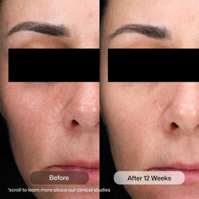 Revision Skincare serum texture closeup demonstrating lightweight absorbency