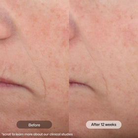 Revision Skincare pump dispensing product illustrating easy single-hand use